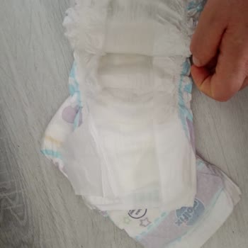 Molfix Bezlerin Yapıştırma Bandı Eksik Çıktı, Hayal Kırıklığı Yaşadım