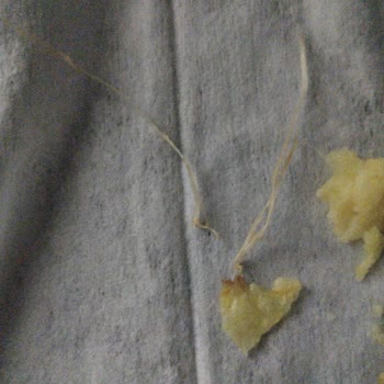 Lay's Klasikten Çıkan İp Şoku