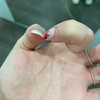 Protez Tırnak Hizmetinde Yaşanan Sorunlar