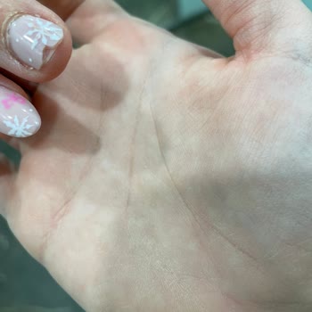 Protez Tırnak Hizmetinde Yaşanan Sorunlar