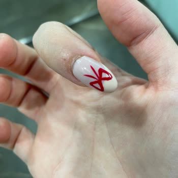 Protez Tırnak Hizmetinde Yaşanan Sorunlar