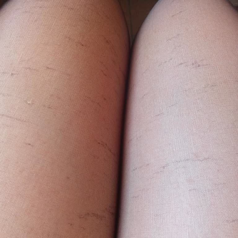 Defolu Çoraplar Ve Hayal Kırıklığı