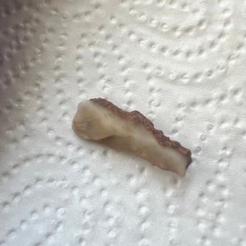 Tehlikeli Kuruyemiş Deneyimi