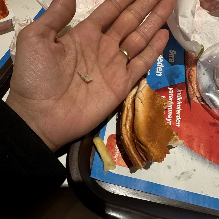 Burger King'de Tavuk Menüden Kemik Parçası Çıktı