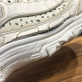 Skechers Ayakkabı 9 Ayda Parçalandı: Acil Çözüm Bekliyorum!