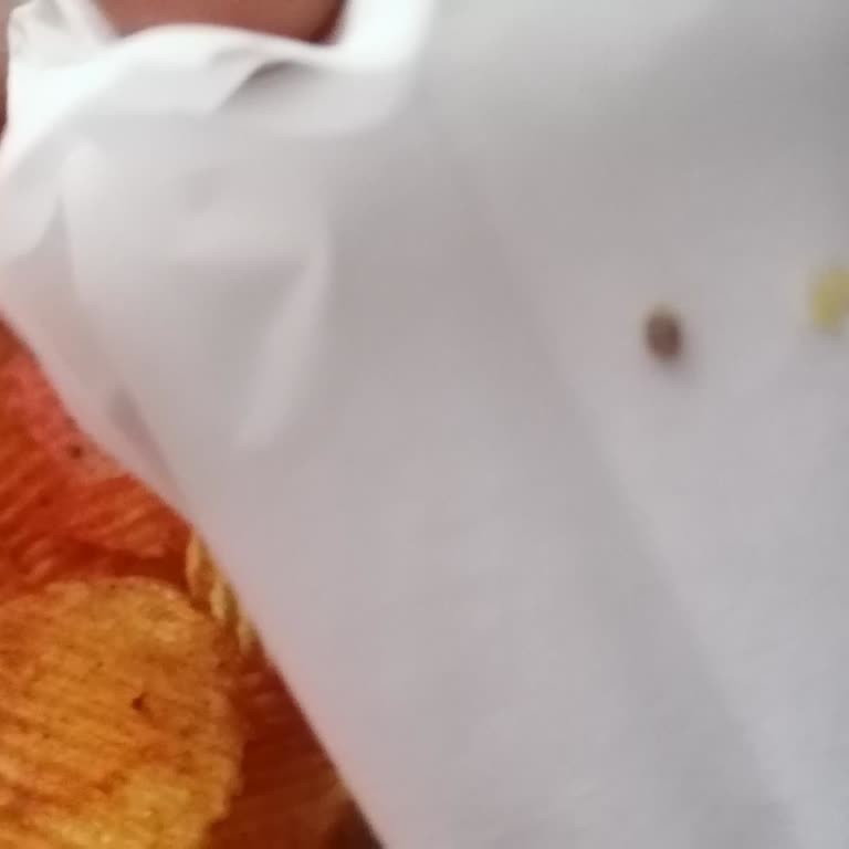Cipsin İçinden Çıkan Taş Dişimi Kırdı!