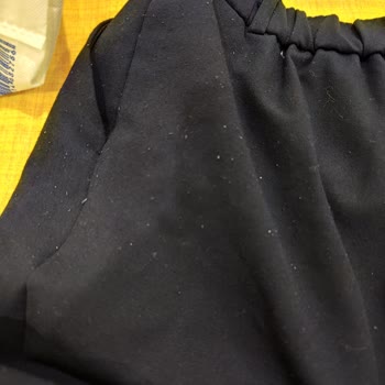 Koton Mağazasında Ürün Tüylenmesi Ve Kaba Hizmet