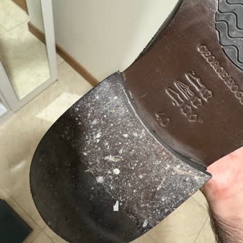 Ayakkabı Deformasyonu Ve İlgisiz Müşteri Hizmeti