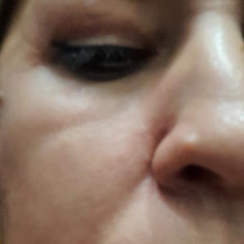 Yves Rocher Ürünleri Alerji Ve İndirim Sorunu