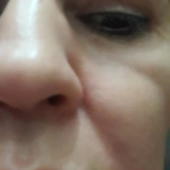 Yves Rocher Ürünleri Alerji Ve İndirim Sorunu