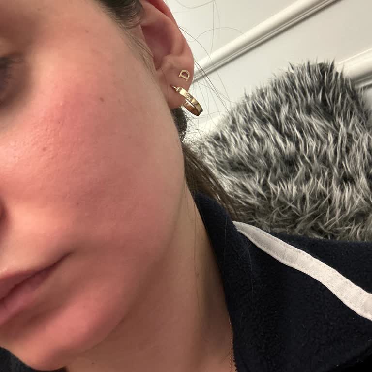 Yves Rocher Yüz Yıkama Jeli Cildimde Yanma Ve Kızarıklık Yaptı