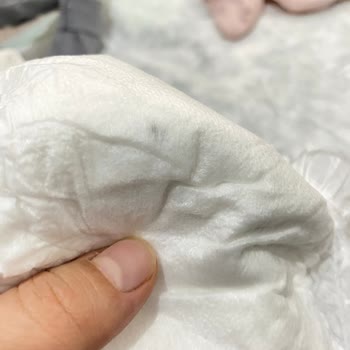 Bebek Bezinde Siyah Leke Şoku