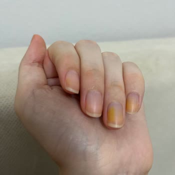 Flormar Ojesi Tırnaklarımda Kalıcı Leke Bıraktı