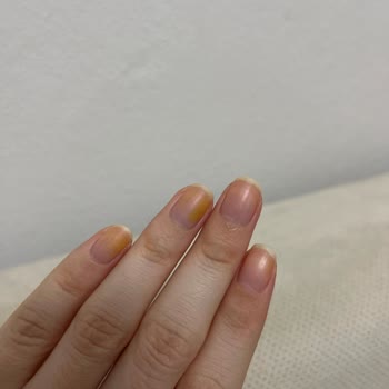 Flormar Ojesi Tırnaklarımda Kalıcı Leke Bıraktı