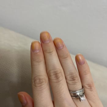 Flormar Ojesi Tırnaklarımda Kalıcı Leke Bıraktı