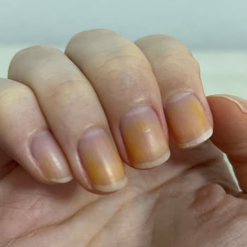 Flormar Ojesi Tırnaklarımda Kalıcı Leke Bıraktı