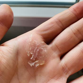 Unique Pet Food Mama İçinden Poşet Çıktı