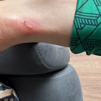 Beymen'de Ayakkabı Sorunu Ve Müşteri Hizmetleri Hayal Kırıklığı