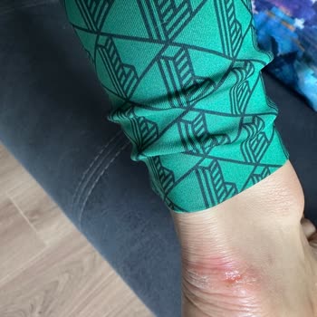 Beymen'de Ayakkabı Sorunu Ve Müşteri Hizmetleri Hayal Kırıklığı