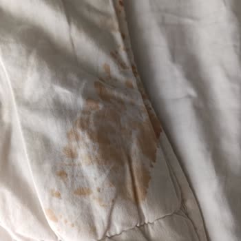 Start Otel Antalya Mağduriyet Yaşama