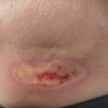 Prenses Beauty Lounge Sincan Sağlık Sorunları Ve İlgisizlik