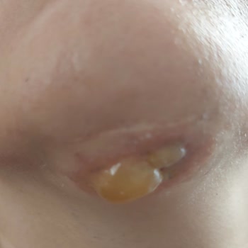 Prenses Beauty Lounge Sincan Sağlık Sorunları Ve İlgisizlik