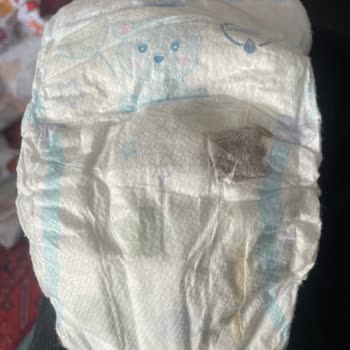 Molfix Bebek Bezinde Hijyen Sorunu: Şok Edici Deneyim