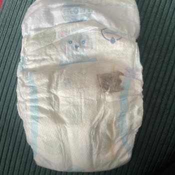 Molfix Bebek Bezinde Hijyen Sorunu: Şok Edici Deneyim