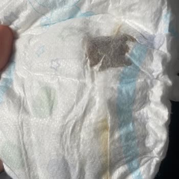 Molfix Bebek Bezinde Hijyen Sorunu: Şok Edici Deneyim