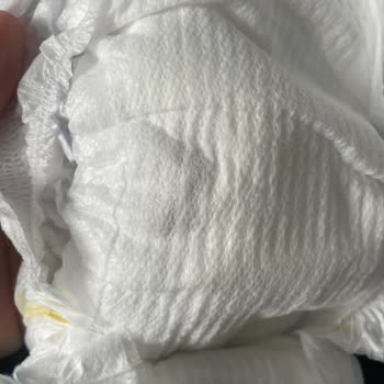 Molfix Bebek Bezinde Hijyen Sorunu: Şok Edici Deneyim