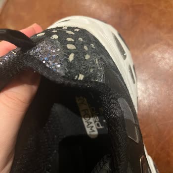Skechers Ayakkabının Kısa Sürede Yıpranması