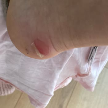 Derimod Botları: Su Geçirmezlik İddiası Ve Müşteri Hizmetleri Hayal Kırıklığı