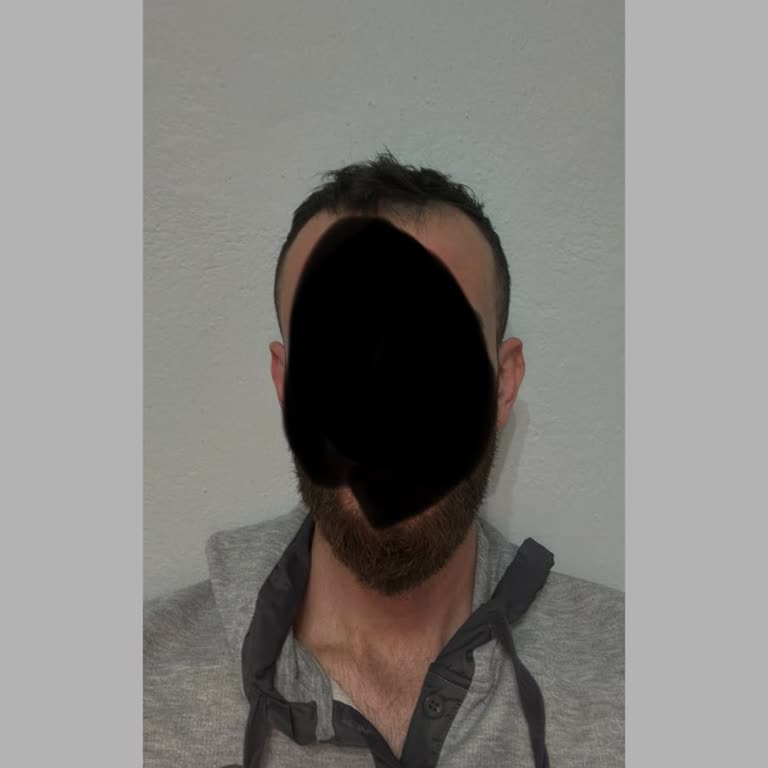 Sim Blokesi Kaldırma Sürecinde Yaşanan Zorluklar