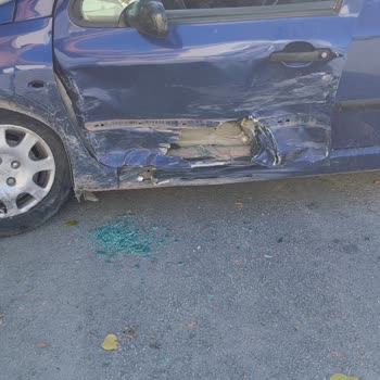 Polis Memuru Avantajı Ve Haksız Eksper Değerlendirmesi