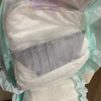 Bebek Bezi İçindeki Şok Edici Durum