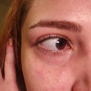 Estee Lauder Eye Concentrate Matrix 15 Ml Caused Severe Reaction and Skin Damage