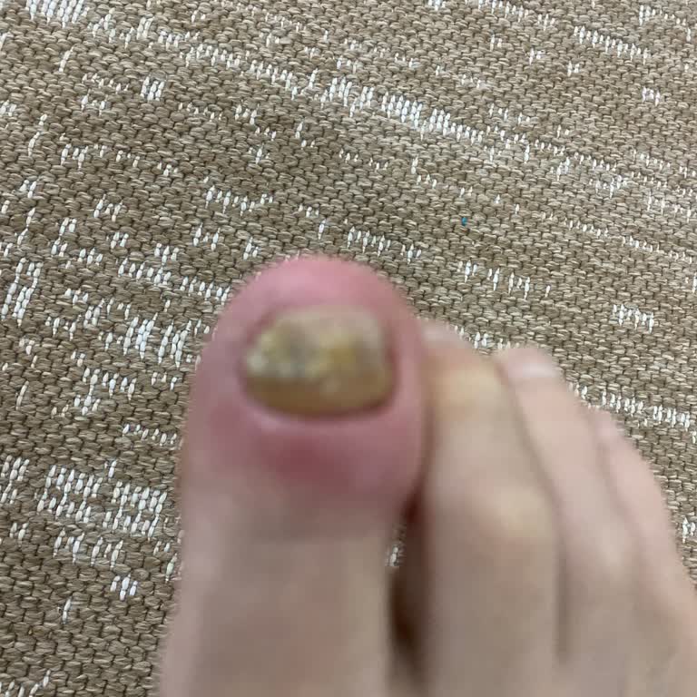 Kocaeli Üniversitesi Hastanesi Podoloji Bölümünde Yetersiz Hizmet Deneyimi