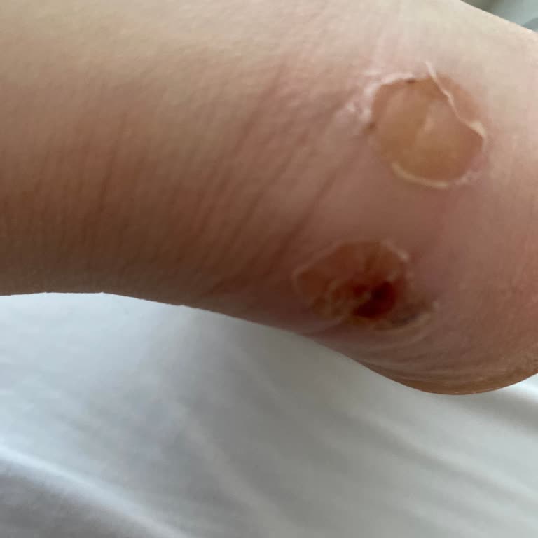 Nine West Ayakkabılar Ayaklarımı Mahvetti