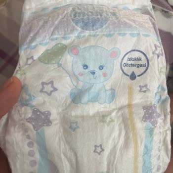 Molfix Bebek Bezinde Hijyen Skandalı