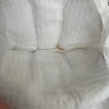 Molfix Bebek Bezinde Hijyen Skandalı