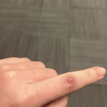 Vip Estetik Güzellik Bakırköy Pişmanlığı