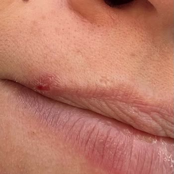 Estetisyen Ceylan Atilla Hep Üstün Çıkmaya Çalışıyorlar