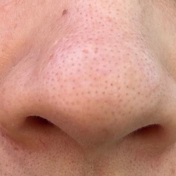 Estetisyen Ceylan Atilla Hep Üstün Çıkmaya Çalışıyorlar