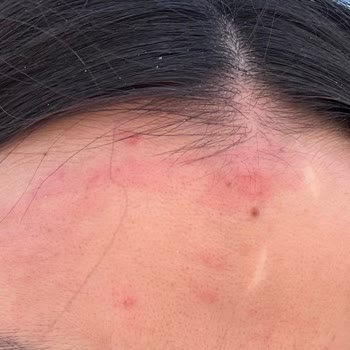 Estetisyen Ceylan Atilla Hep Üstün Çıkmaya Çalışıyorlar