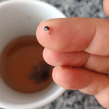 Çay Paketinde Şok Edici Yabancı Cisim