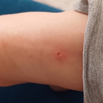 LCW Waikiki Kar Botu Ayağıma Zarar Verdi