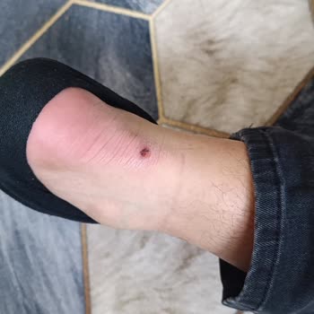 Ayakkabı Kalitesizliği Ve İade Sürecinde Sorun