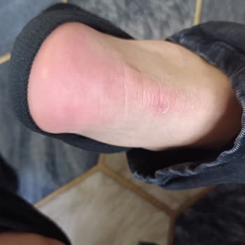 Ayakkabı Kalitesizliği Ve İade Sürecinde Sorun