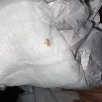 Bebek Bezlerinde Anlaşılmaz Böcek Sorunu