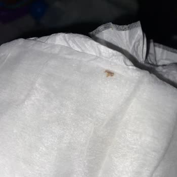 Bebek Bezlerinde Anlaşılmaz Böcek Sorunu